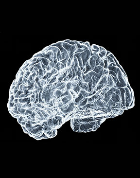Image for Cognitive Rehabilitation Strategies